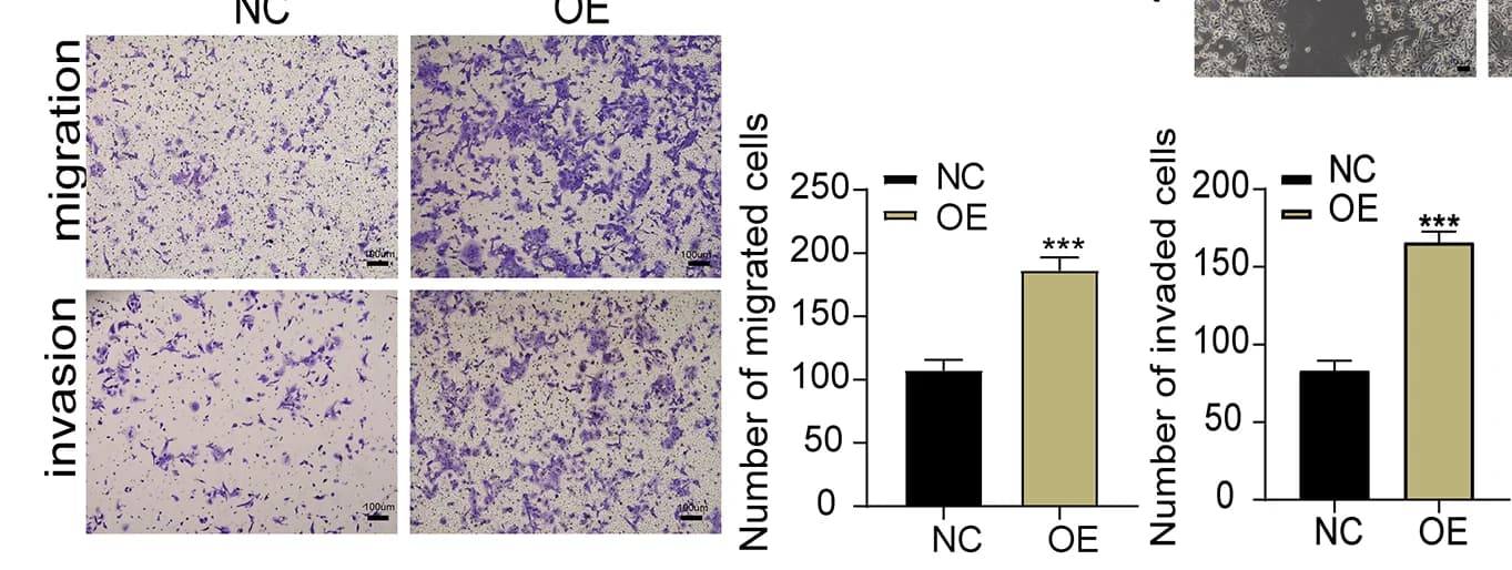 Open access visualization of Bar Plot, Error Bars, Microscopy, Cell Migration, Cell Invasion