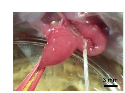 Open access visualization of Photo, Luminal Surface, Cecum