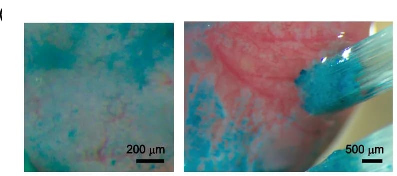 Open access visualization of Microscopy, Photo, Cecal Surface, Fast Green, Crypts