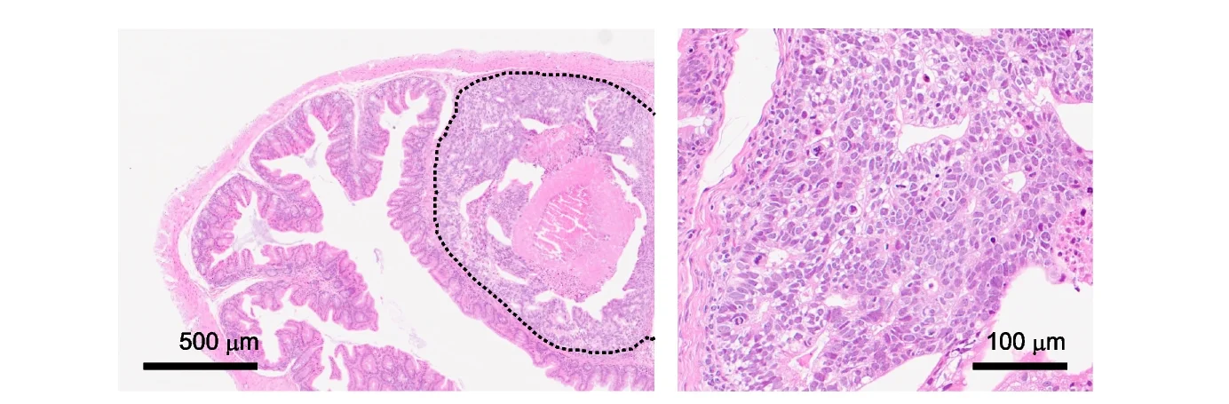 Open access visualization of Microscopy, H&E Staining, Cecum, Caco-2-mScarlet Cells, Xenografted Region