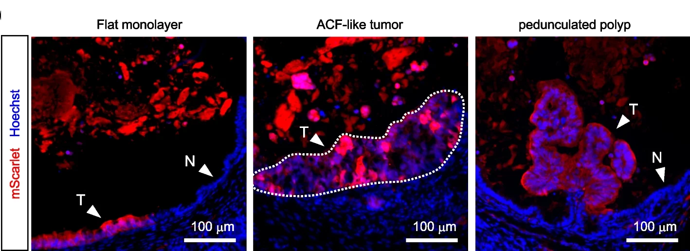 Open access visualization of Microscopy, Caco-2-mScarlet Cells, Tumors, Flat Monolayer Tumor Foci, Caco-2 Cells