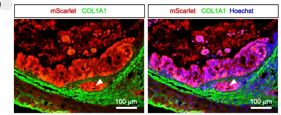 Open access visualization of Microscopy, Tumor Foci, Epithelial Layer, Collagen Layer, Invasive Foci