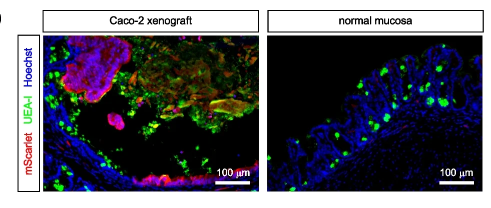 Open access visualization of Microscopy, Goblet Cell Granules, Rhodamine-UEA-I, Tumors, UEA-I-Positive Cells