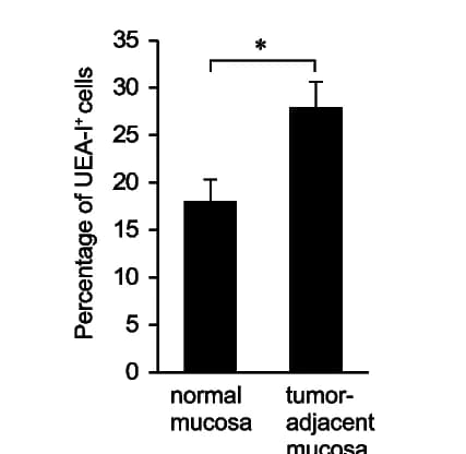 Open access visualization of Bar Plot, Error Bars, UEA-I-Positive Goblet Cells, Normal Mucosa, Tumor-Adjacent Mucosa