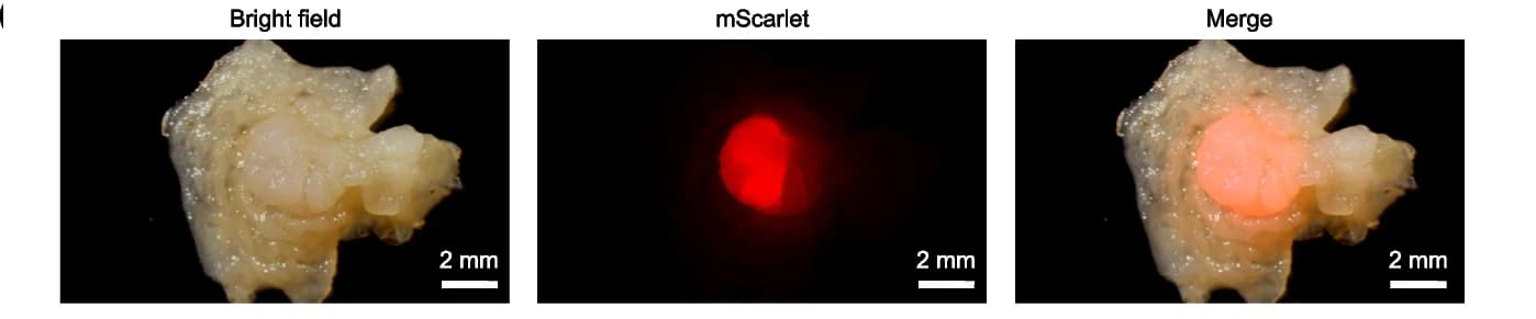 Open access visualization of Microscopy, Photo, Caco-2 Cell Tumor, Gross View, Magnified View