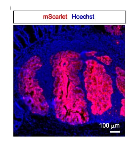 Open access visualization of Microscopy, Caco-2 Cells, Tumor, Epithelium, Hoechst33342
