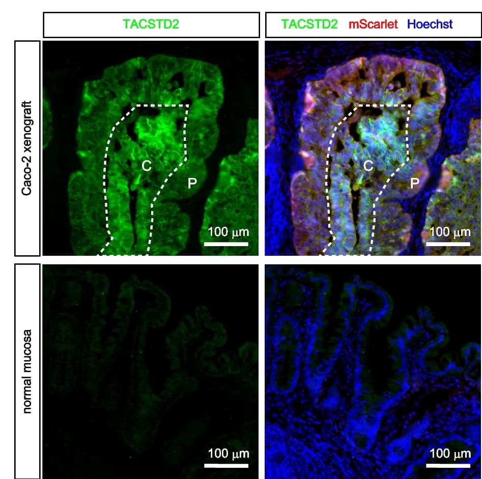 Open access visualization of Microscopy, Fetal Intestinal Marker, TACSTD2, Tumor Cells, Caco-2 Tumors