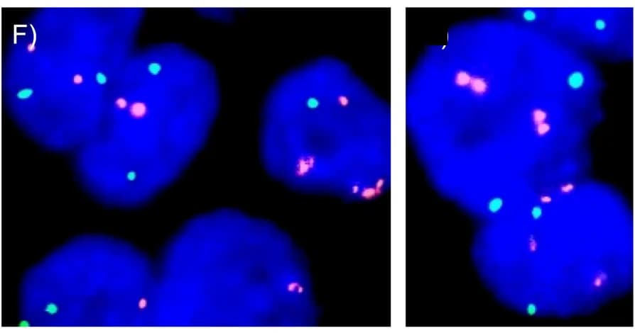 Open access visualization of Microscopy, Chromosome Y, Chromosome X