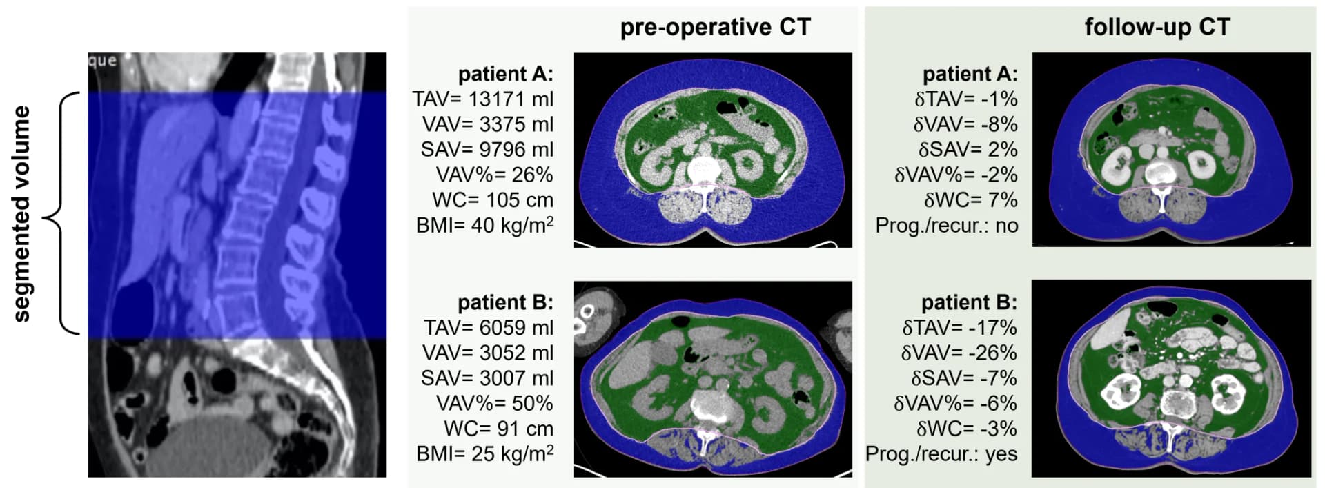 Open access visualization of Microscopy, Abdominal Fat, Computed Tomography Scans, Segmentation