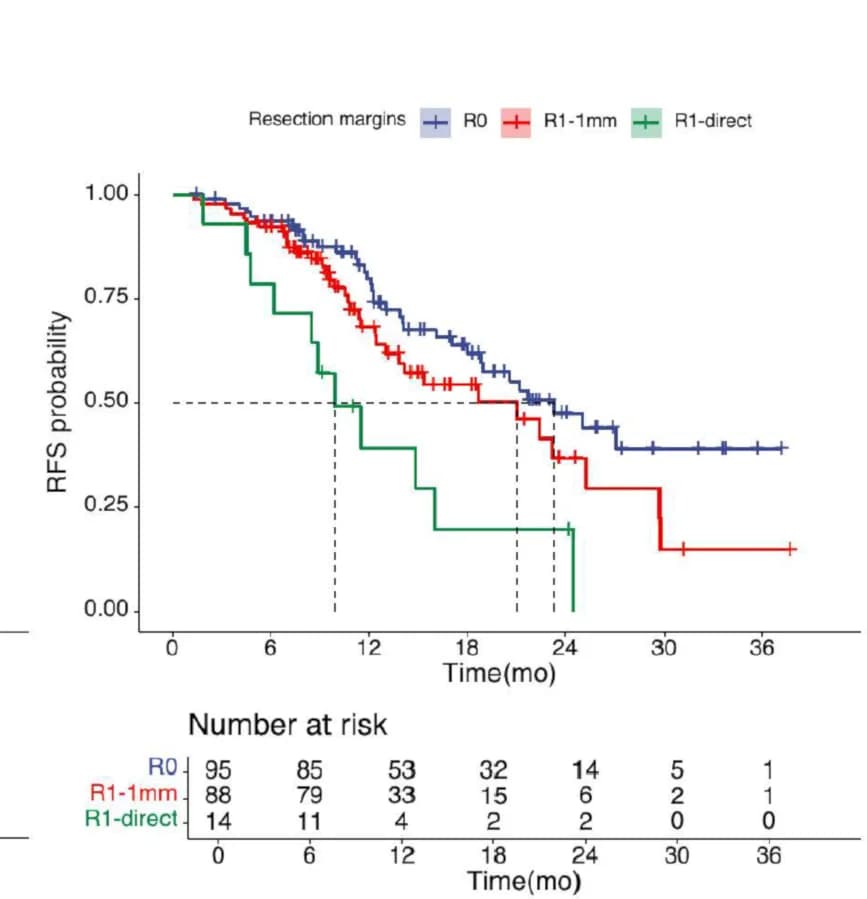 Open access visualization of Survival Curve, Kaplan Meier plots, RFS, Resection Margin