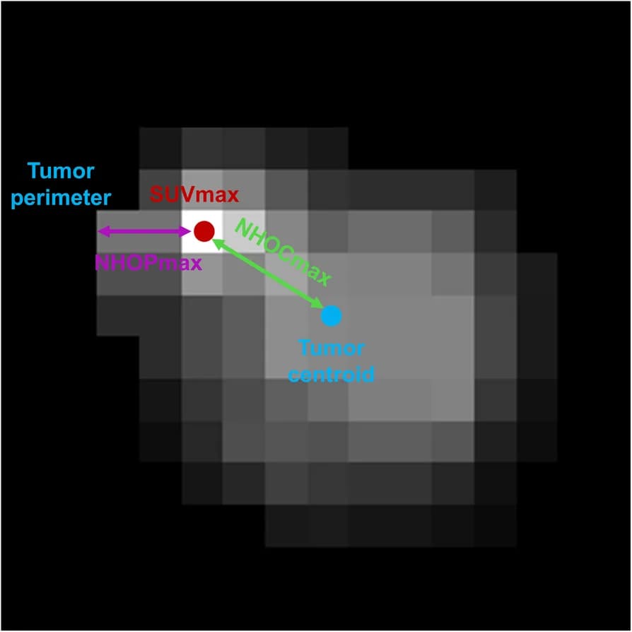 Open access visualization of Microscopy, NHOCmax, NHOPmax, Diagram