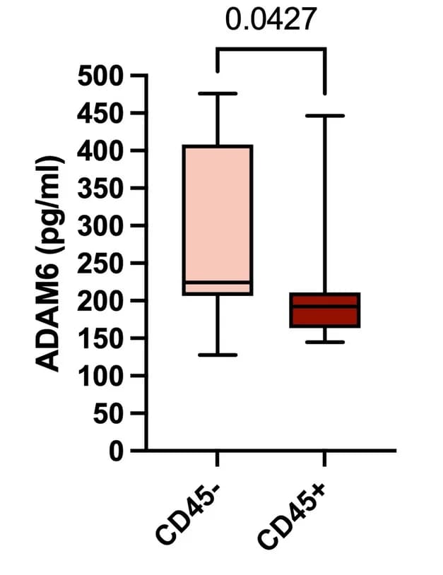 Open access visualization of Box Plot, ADAM6, CD45, ALL Patients, Serum