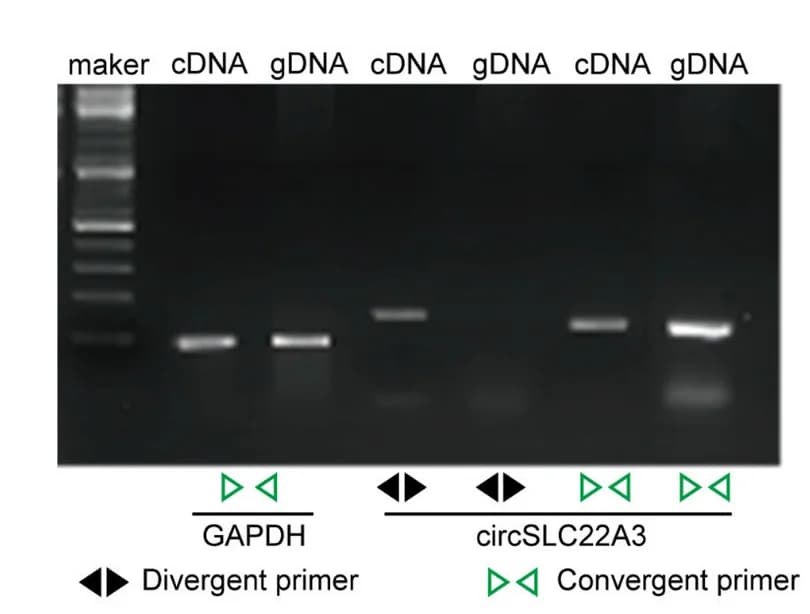 Open access visualization of Gel, PCR Assay, CircSLC22A3, cDNA, gDNA