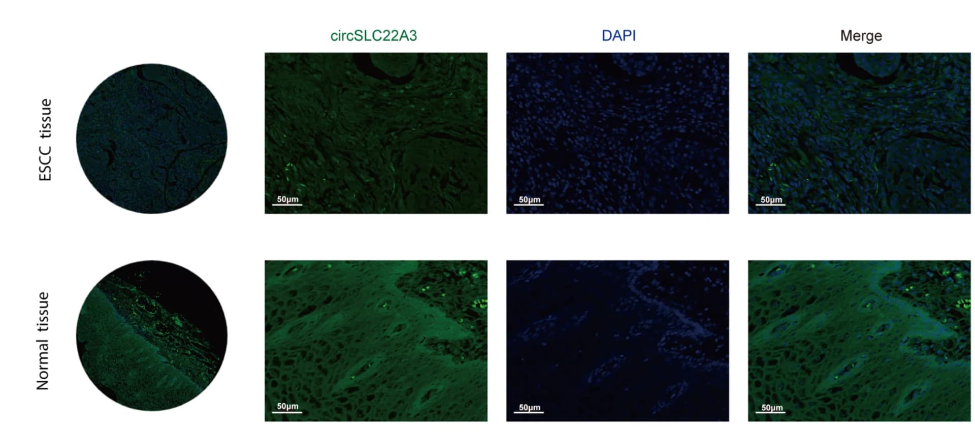 Open access visualization of Microscopy, RNA FISH, Tissue Microarray, ESCC Tissues, Adjacent Tissues