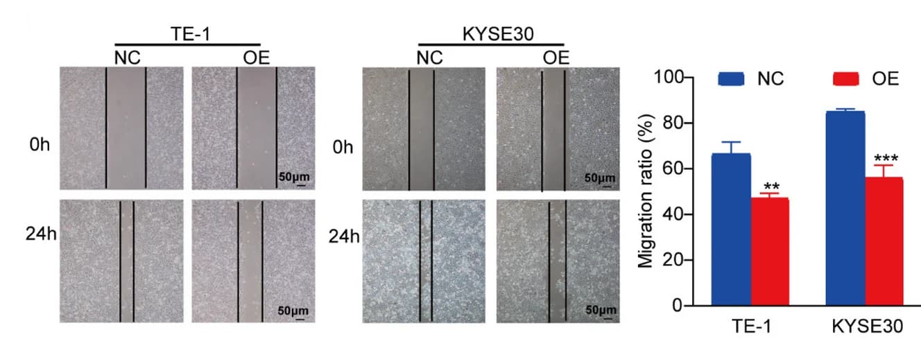 Open access visualization of Bar Plot, Microscopy, circSLC22A3, TE-1 Cells, KYSE30 Cells