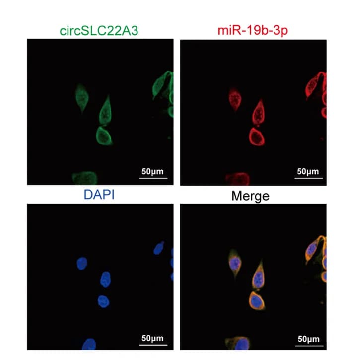 Open access visualization of Microscopy, Confocal Microscopy, circSLC22A3, miR-19b-3p, Cytoplasm