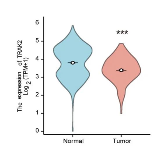Open access visualization of Violin Plot, TCGA Database, TRAK2 Expression, ESCC Tissues