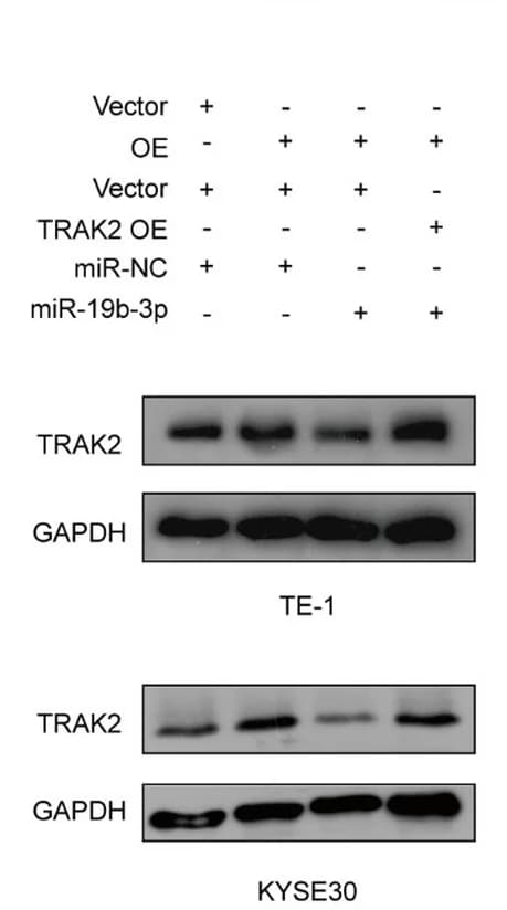 Open access visualization of Gel, Western Blot Assay, TRAK2 Protein Expression, circSLC22A3 Overexpression, miR-19b-3p Mimic