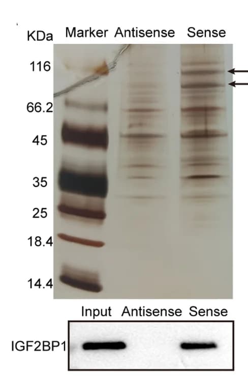 Open access visualization of Gel, RNA Pulldown, Western Blot, circSLC22A3, IGF2BP1