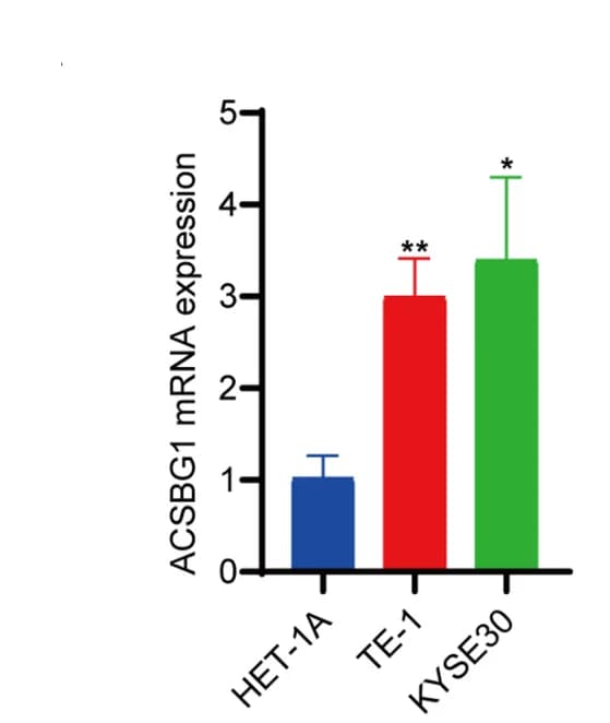 Open access visualization of Bar Plot, Error Bars, ACSBG1, ESCC Tissues, ESCC Cells