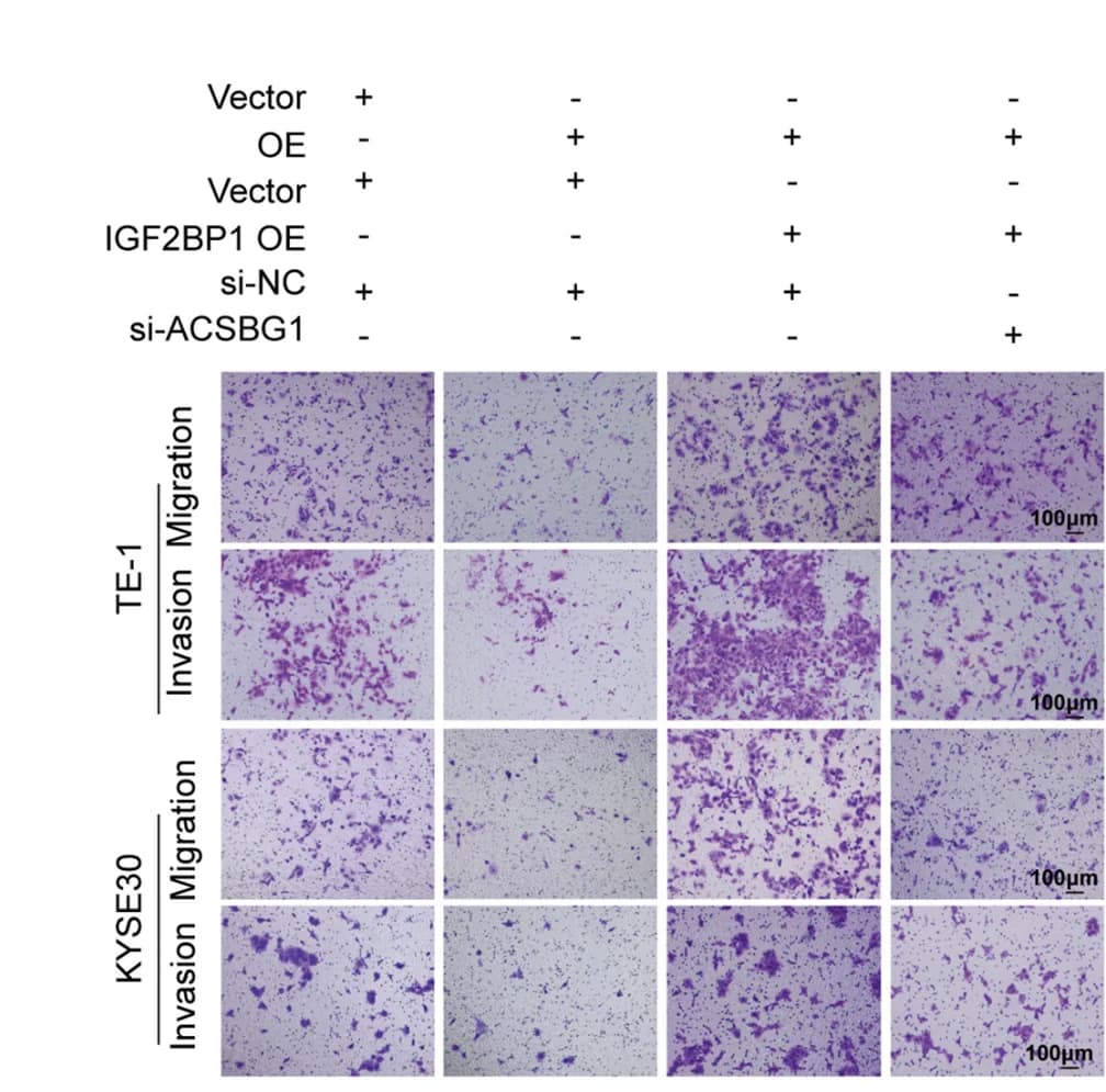 Open access visualization of Microscopy, circSLC22A3, ACSBG1, IGF2BP1, ESCC Cell Migration