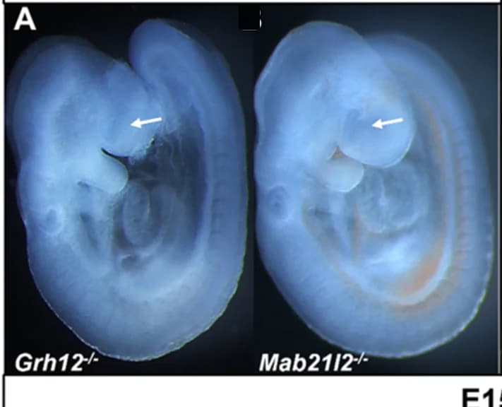 Open access visualization of Microscopy, Embryos, Null Mutations, Optic Vesicle, E9.5