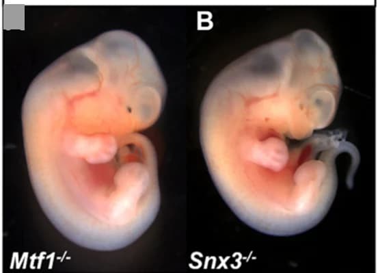 Open access visualization of Photo, Embryos, Microphthalmia, Anophthalmia, Mutations
