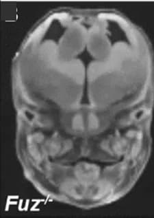 Open access visualization of Photo, MicroCT, Eye Abnormalities, Null Embryos, Bilateral Anophthalmia