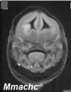 Open access visualization of Microscopy, MicroCT, Eye Abnormalities, Null Embryos, Bilateral Anophthalmia