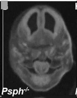 Open access visualization of Microscopy, MicroCT, Eye Abnormalities, Null Embryos, Bilateral Anophthalmia