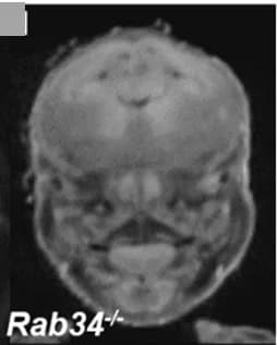 Open access visualization of Microscopy, MicroCT, Eye Abnormalities, Null Embryos, Bilateral Anophthalmia