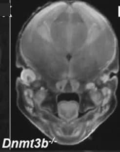 Open access visualization of Microscopy, MicroCT, Eye Abnormalities, Null Embryos, Anophthalmia