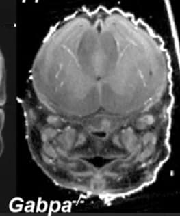 Open access visualization of Microscopy, MicroCT, Eye Abnormalities, Null Embryos, Anophthalmia