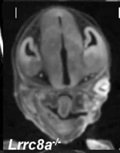 Open access visualization of Microscopy, MicroCT, Eye Abnormalities, Null Embryos, Anophthalmia