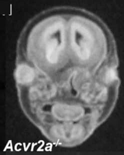 Open access visualization of Microscopy, MicroCT, Eye Abnormalities, Null Embryos, Microphthalmia