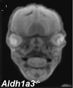 Open access visualization of Microscopy, MicroCT, Eye Abnormalities, Null Embryos, Microphthalmia