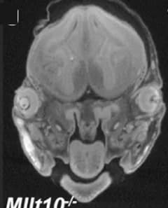 Open access visualization of Microscopy, MicroCT, Eye Abnormalities, Null Embryos, Microphthalmia