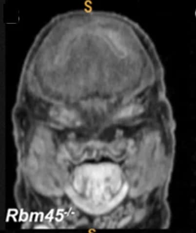 Open access visualization of Microscopy, MicroCT, Eye, Embryos, Null