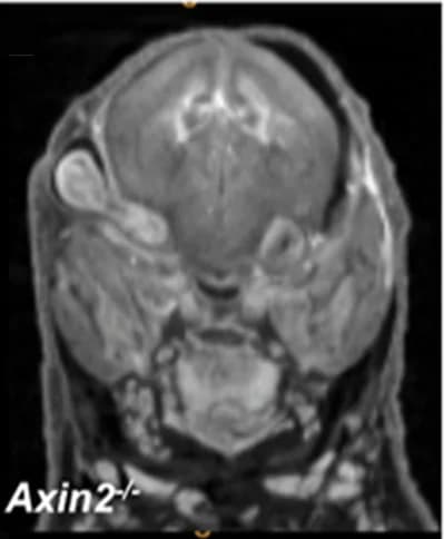 Open access visualization of Microscopy, MicroCT, Eye, Embryos, Null