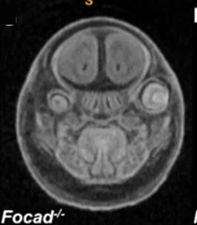 Open access visualization of Microscopy, MicroCT, Eye, Embryos, Null