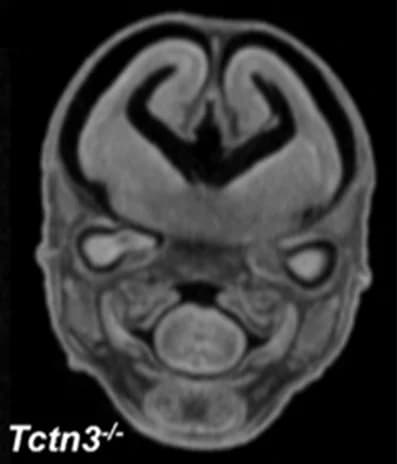 Open access visualization of Microscopy, MicroCT, Eye, Embryos, Null