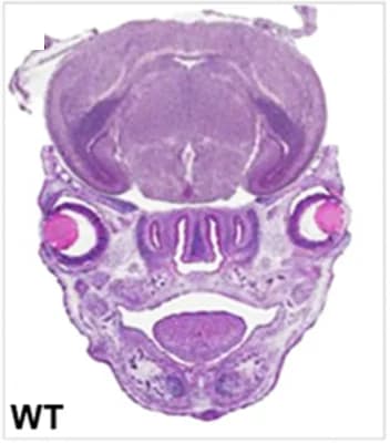 Open access visualization of Microscopy, Coronal Sections, E15.5 Embryos, Hematoxylin and Eosin, MAC Phenotypes