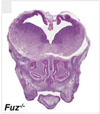 Open access visualization of Microscopy, Coronal Sections, Homozygous, E15.5 Embryos, Hematoxylin and Eosin