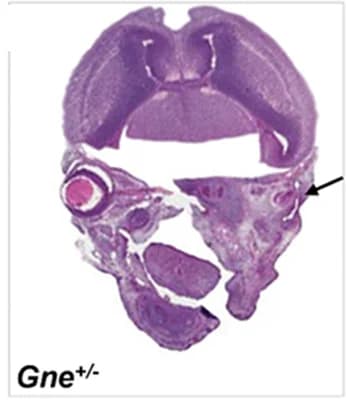 Open access visualization of Microscopy, Coronal Sections, Heterozygous, E15.5 Embryos, Hematoxylin and Eosin