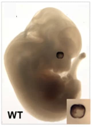 Open access visualization of Photo, Embryo, LacZ histochemistry, Heterozygous, Gene expression