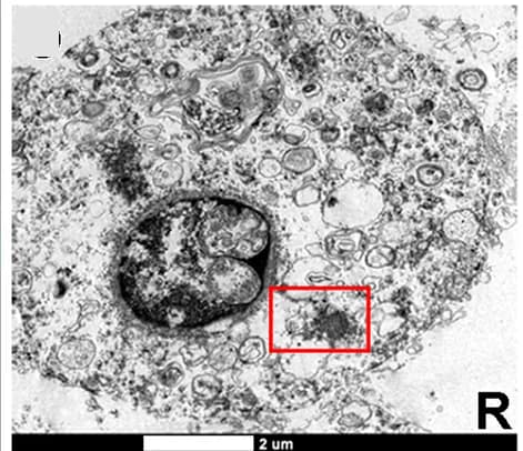 Open access visualization of Microscopy, TEM, Viral Particles, Round Spermatids