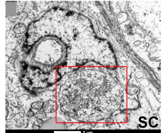 Open access visualization of Microscopy, TEM, Viral Particles, Sertoli Cells