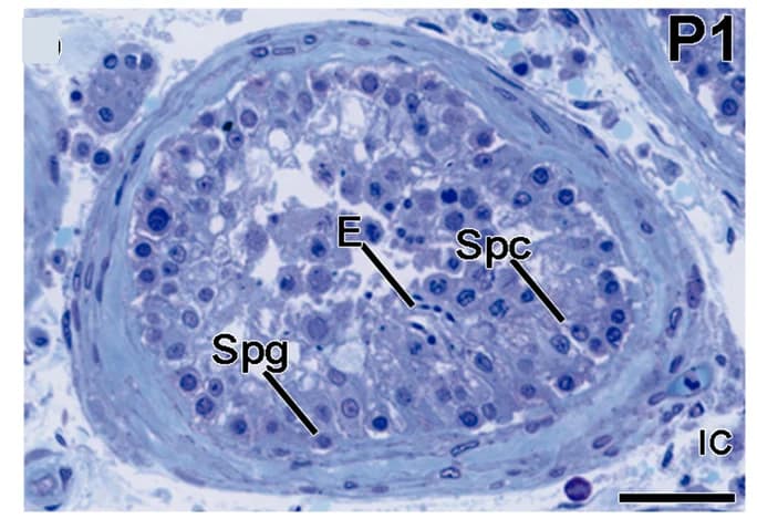 Open access visualization of Microscopy, COVID-19 Patients, Elongated Spermatids, Spermatocytes, Spermatogonial Cells