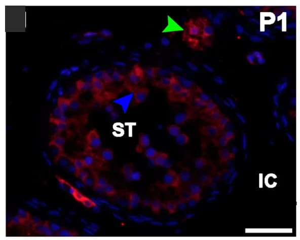 Open access visualization of Microscopy, ACE2, Testis, COVID-19 Patients, Immunostaining