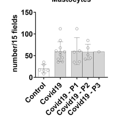 Open access visualization of Bar Plot, Error Bars, Scatter Plot, Mast Cells, Testis Parenchyma